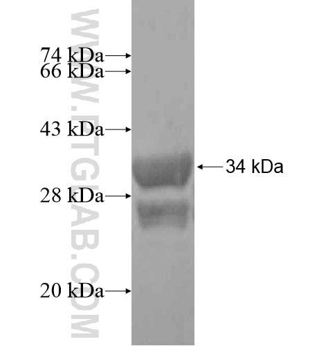 KIAA1984 fusion protein Ag15053 SDS-PAGE