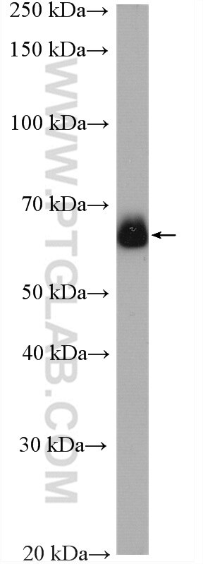 Western Blot (WB) analysis of U2OS cells using KIAA2013 Polyclonal antibody (27886-1-AP)