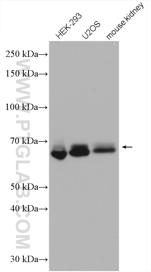 Western Blot (WB) analysis of various lysates using KIAA2013 Polyclonal antibody (27886-1-AP)