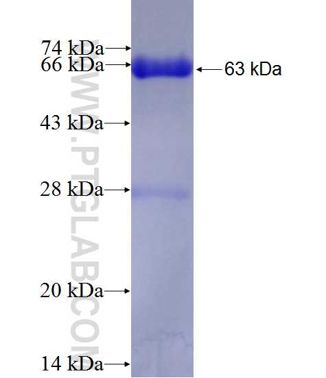 KIAA2013 fusion protein Ag27379 SDS-PAGE