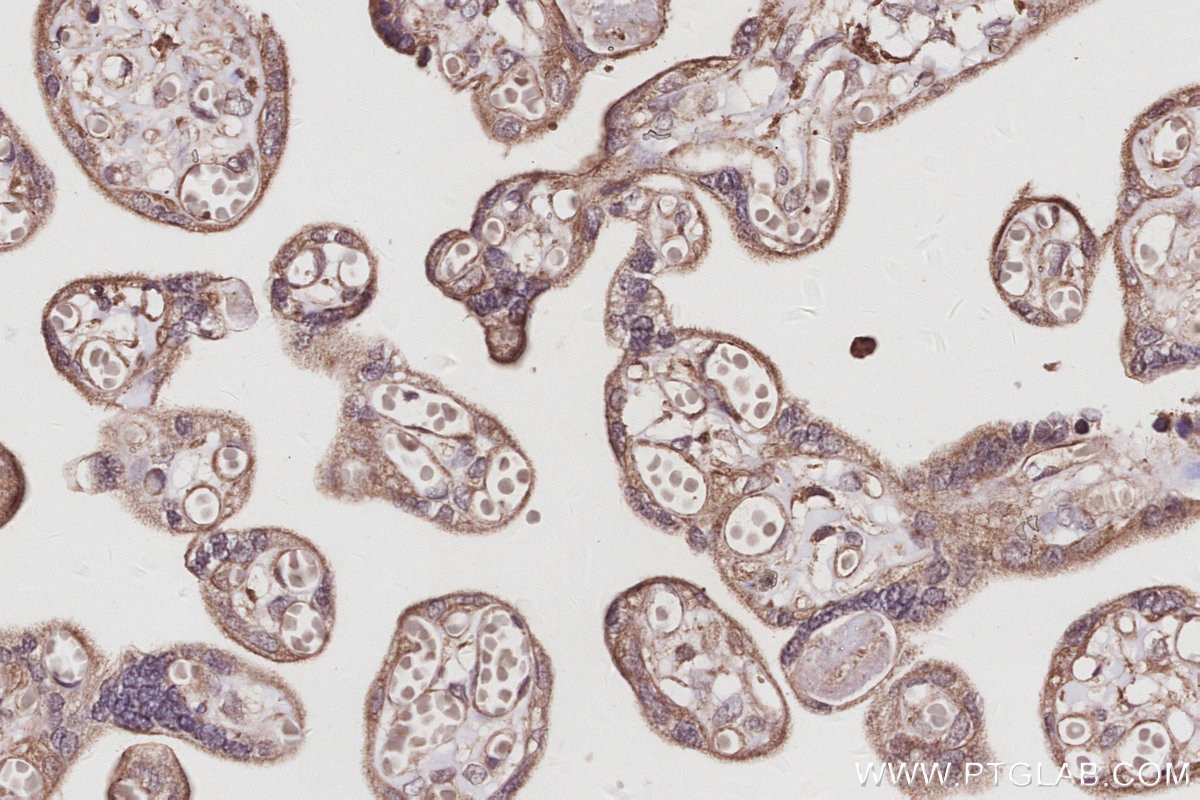 Immunohistochemistry (IHC) staining of human placenta tissue using KIDINS220 Polyclonal antibody (21856-1-AP)