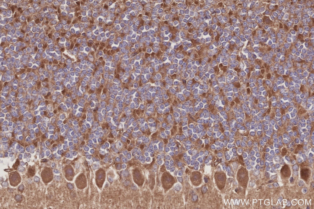 Immunohistochemistry (IHC) staining of mouse cerebellum tissue using KIDINS220 Polyclonal antibody (21856-1-AP)