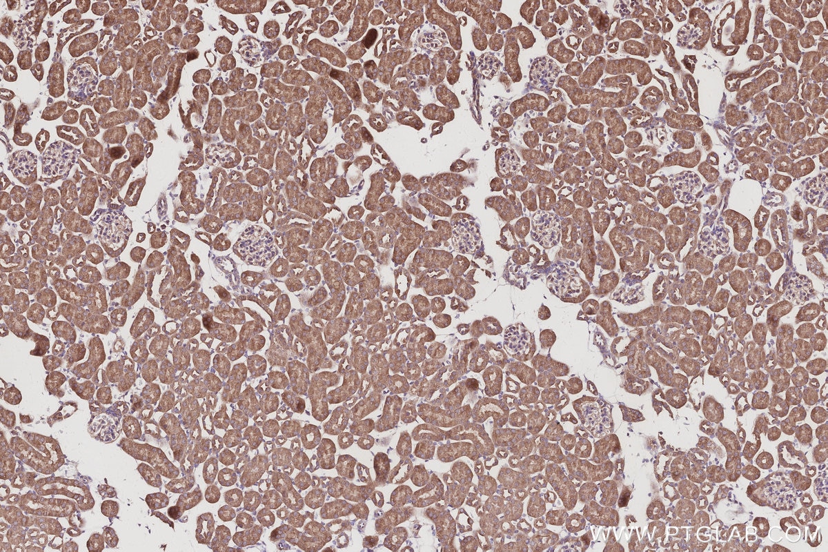 Immunohistochemistry (IHC) staining of mouse kidney tissue using KIDINS220 Polyclonal antibody (21856-1-AP)