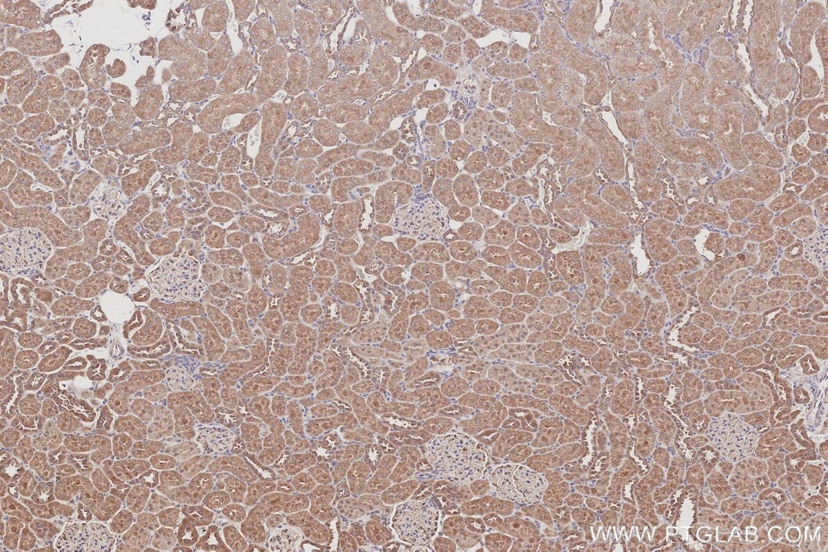 Immunohistochemistry (IHC) staining of rat kidney tissue using KIDINS220 Polyclonal antibody (21856-1-AP)