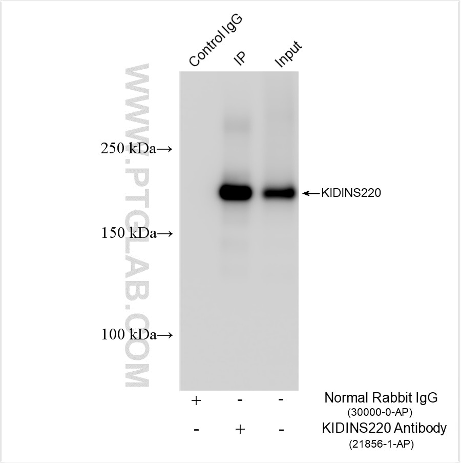 Immunoprecipitation (IP) experiment of HEK-293 cells using KIDINS220 Polyclonal antibody (21856-1-AP)