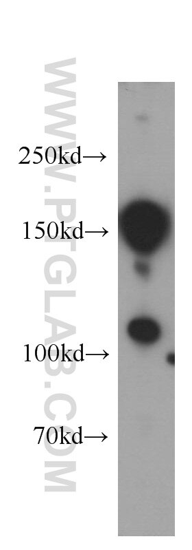 Western Blot (WB) analysis of human brain tissue using KIDINS220 Polyclonal antibody (21856-1-AP)