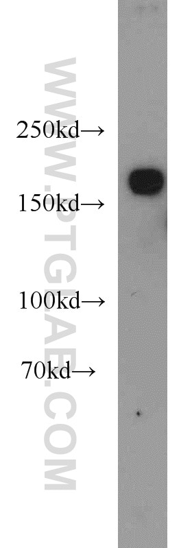 Western Blot (WB) analysis of HeLa cells using KIDINS220 Polyclonal antibody (21856-1-AP)
