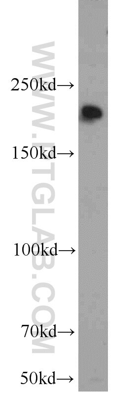 Western Blot (WB) analysis of HEK-293 cells using KIDINS220 Polyclonal antibody (21856-1-AP)