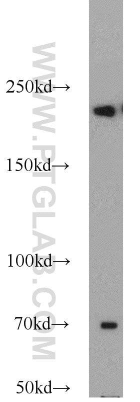 Western Blot (WB) analysis of Raji cells using KIDINS220 Polyclonal antibody (21856-1-AP)