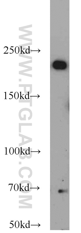 Western Blot (WB) analysis of Raji cells using KIDINS220 Polyclonal antibody (21856-1-AP)