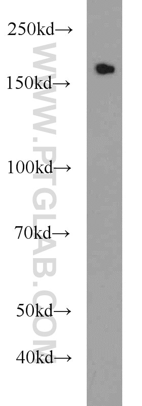 Western Blot (WB) analysis of HeLa cells using KIDINS220 Polyclonal antibody (21856-1-AP)