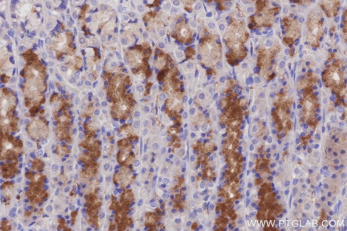 Immunohistochemistry (IHC) staining of rat stomach tissue using KIDINS220 Monoclonal antibody (66748-1-Ig)