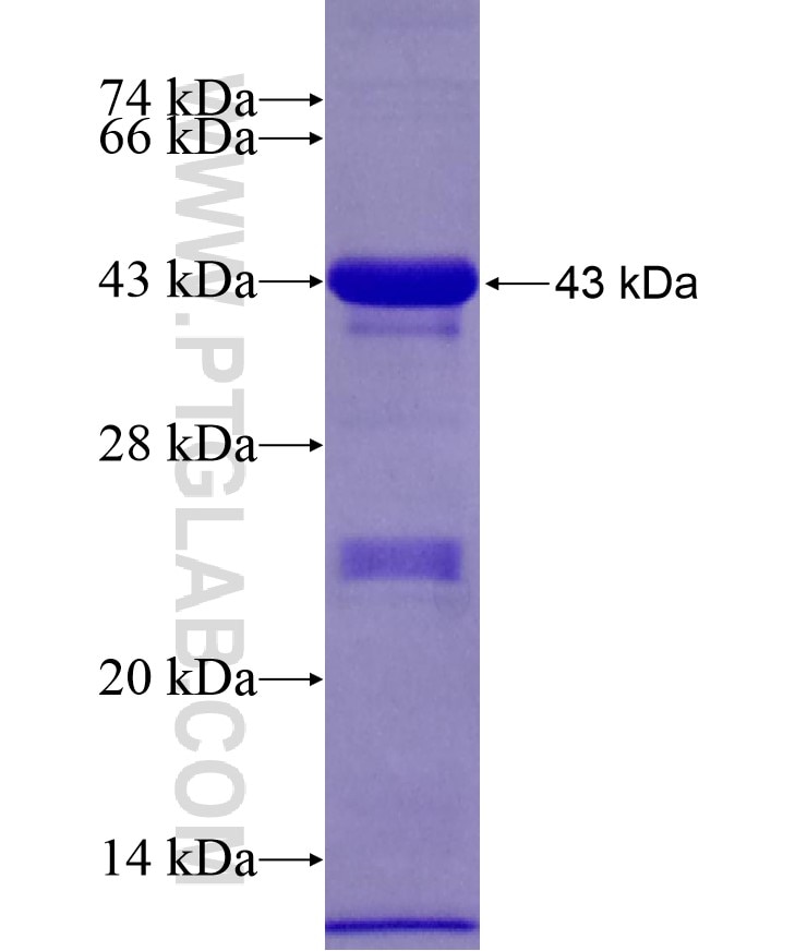 KIDINS220 fusion protein Ag17624 SDS-PAGE