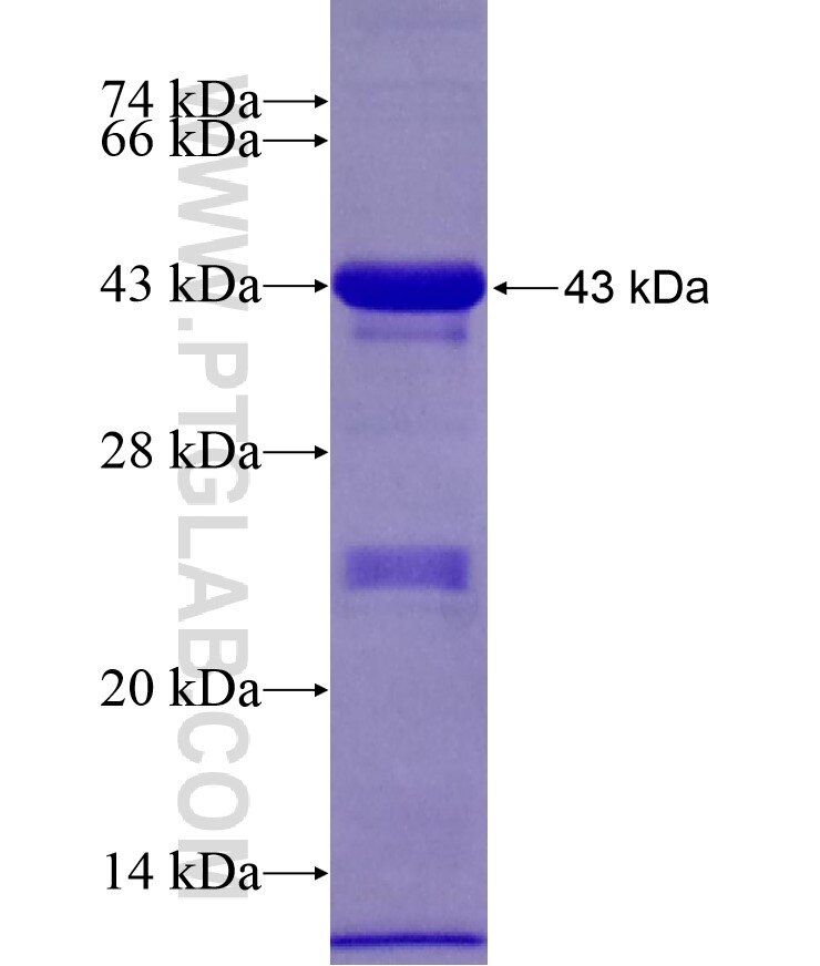 KIDINS220 fusion protein Ag17624 SDS-PAGE