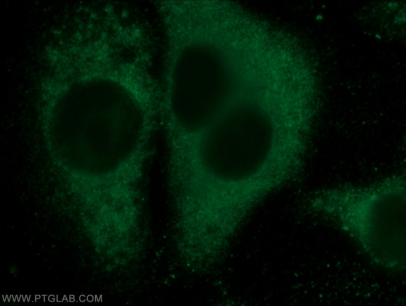 Immunofluorescence (IF) / fluorescent staining of HepG2 cells using Eg5 Polyclonal antibody (23333-1-AP)