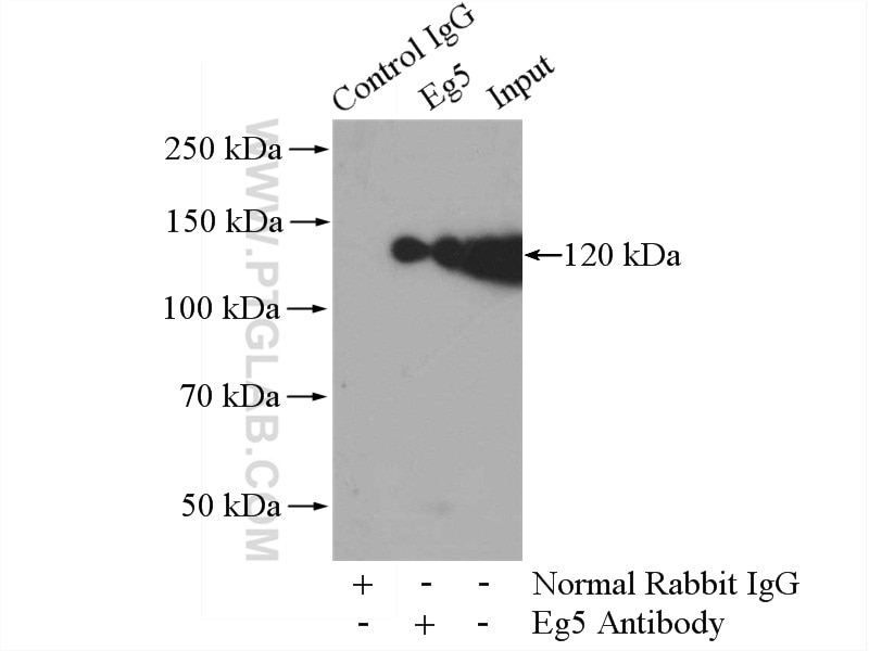 Immunoprecipitation (IP) experiment of Raji cells using Eg5 Polyclonal antibody (23333-1-AP)