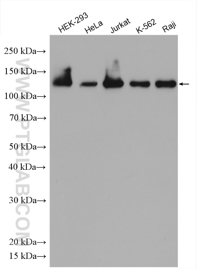 Western Blot (WB) analysis of various lysates using Eg5 Polyclonal antibody (23333-1-AP)