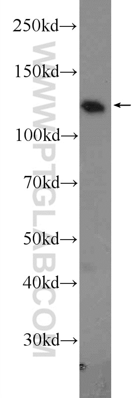 Eg5 Polyclonal antibody