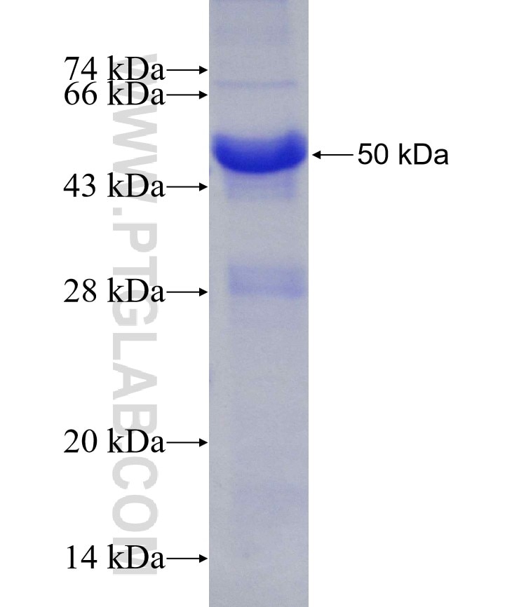 KIF11 fusion protein Ag20001 SDS-PAGE