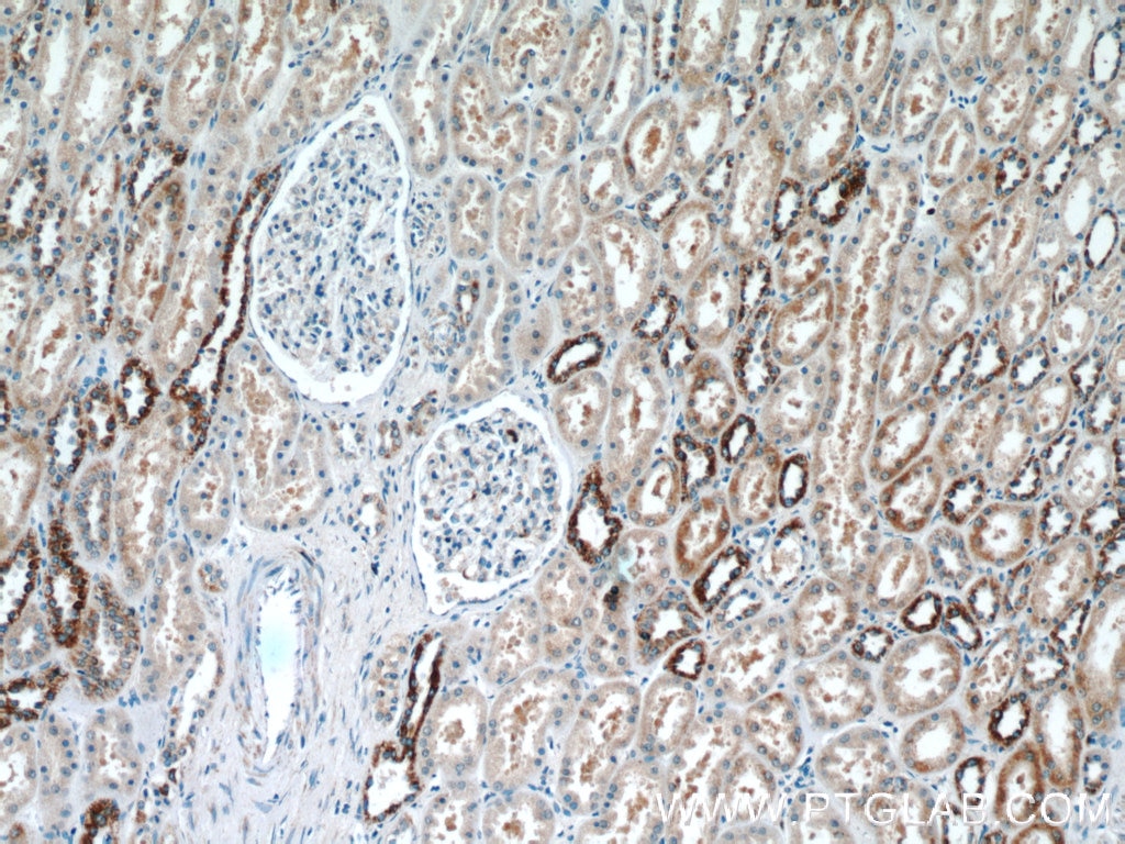 Immunohistochemistry (IHC) staining of human kidney tissue using KIF12 Polyclonal antibody (12035-1-AP)