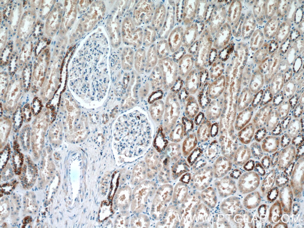 Immunohistochemistry (IHC) staining of human kidney tissue using KIF12 Polyclonal antibody (12035-1-AP)