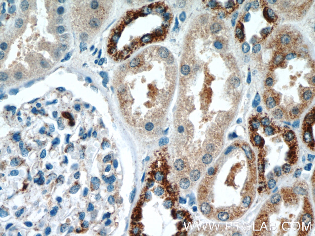 IHC staining of human kidney using 12035-1-AP