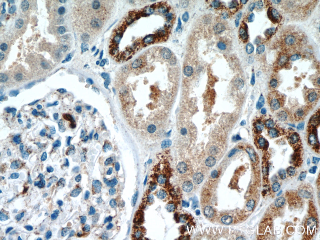 Immunohistochemistry (IHC) staining of human kidney tissue using KIF12 Polyclonal antibody (12035-1-AP)