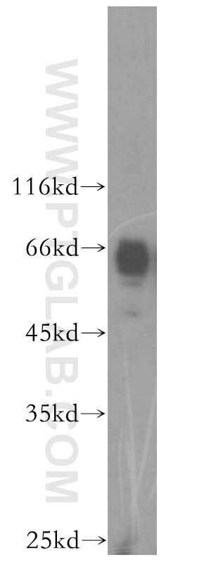 Western Blot (WB) analysis of Y79 cells using KIF12 Polyclonal antibody (12035-1-AP)