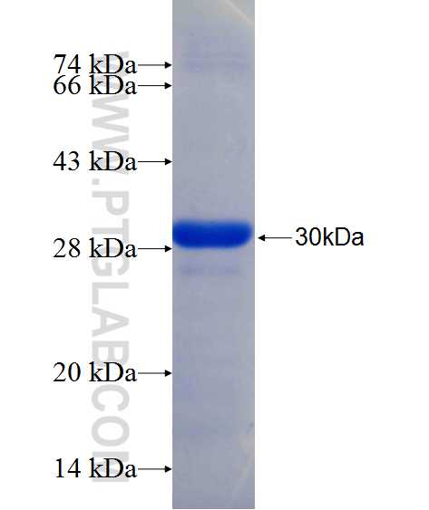 KIF13A fusion protein Ag24356 SDS-PAGE