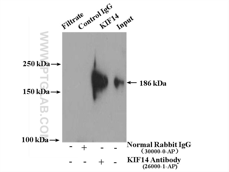 Immunoprecipitation (IP) experiment of HEK-293T cells using KIF14 Polyclonal antibody (26000-1-AP)
