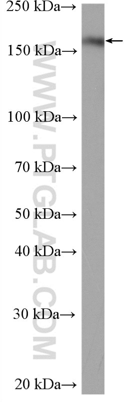 Western Blot (WB) analysis of HEK-293T cells using KIF14 Polyclonal antibody (26000-1-AP)