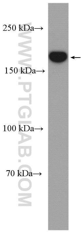 Western Blot (WB) analysis of HeLa cells using KIF14 Polyclonal antibody (26000-1-AP)