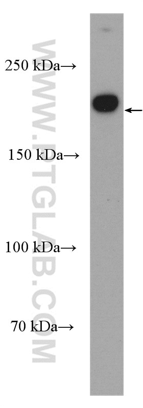 Western Blot (WB) analysis of T-47D cells using KIF14 Polyclonal antibody (26000-1-AP)