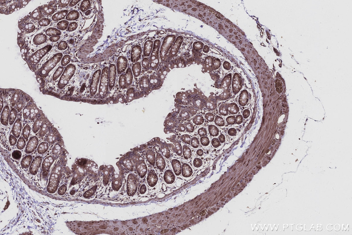 IHC staining of mouse colon using 30774-1-AP Immunohistochemistry (IHC) staining of mouse colon tissue using KIF15 Polyclonal antibody (30774-1-AP)