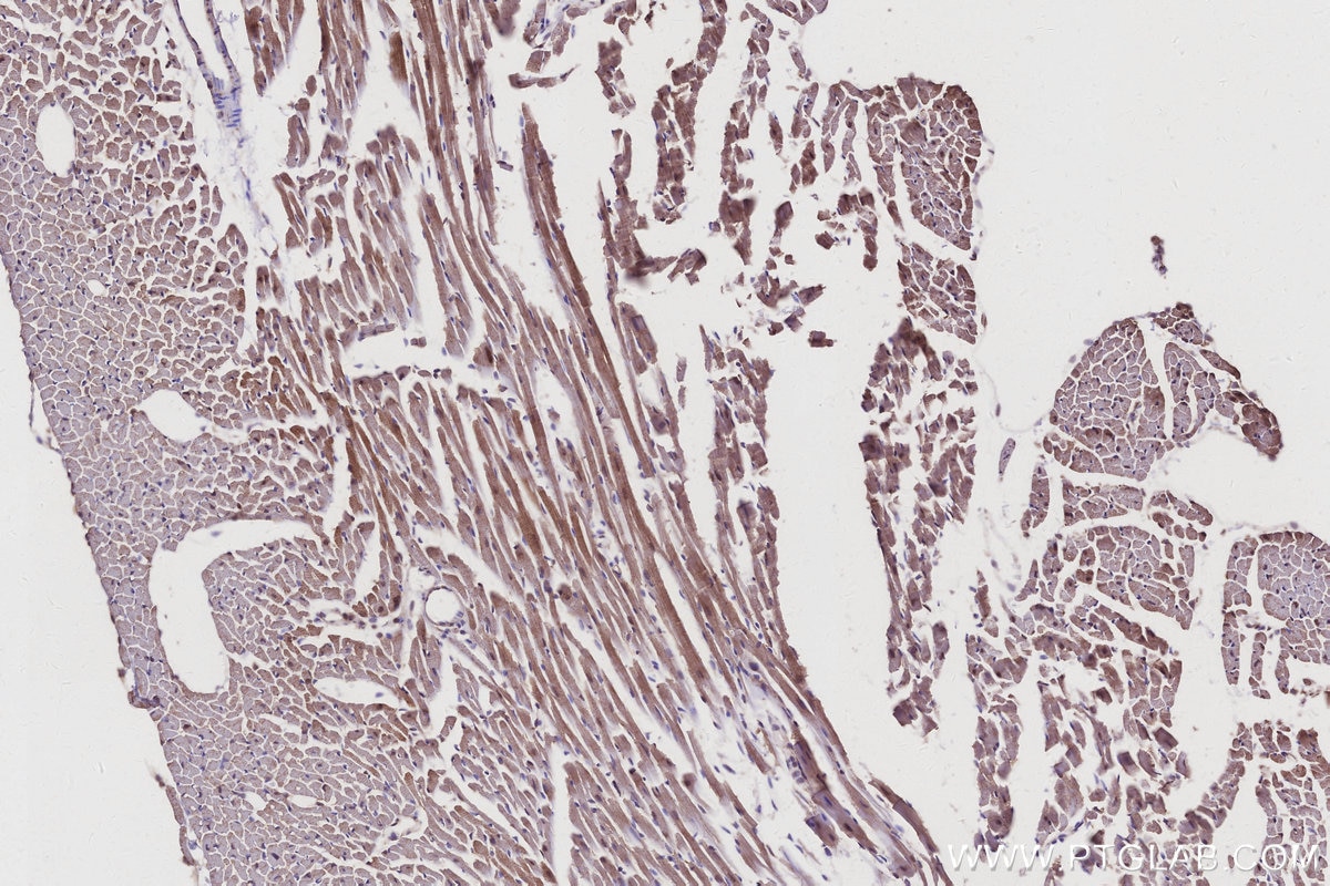 Immunohistochemistry (IHC) staining of mouse heart tissue using KIF15 Polyclonal antibody (30774-1-AP)