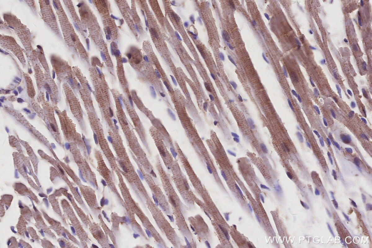IHC staining of mouse heart using 30774-1-AP Immunohistochemistry (IHC) staining of mouse heart tissue using KIF15 Polyclonal antibody (30774-1-AP)