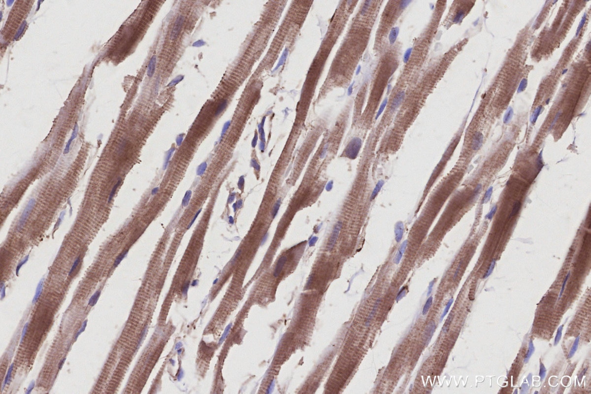 Immunohistochemistry (IHC) staining of rat heart tissue using KIF15 Polyclonal antibody (30774-1-AP)