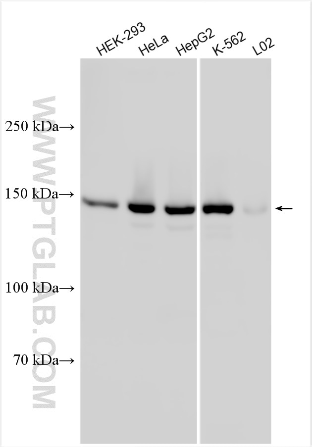 Western Blot (WB) analysis of various lysates using KIF15 Polyclonal antibody (30774-1-AP)