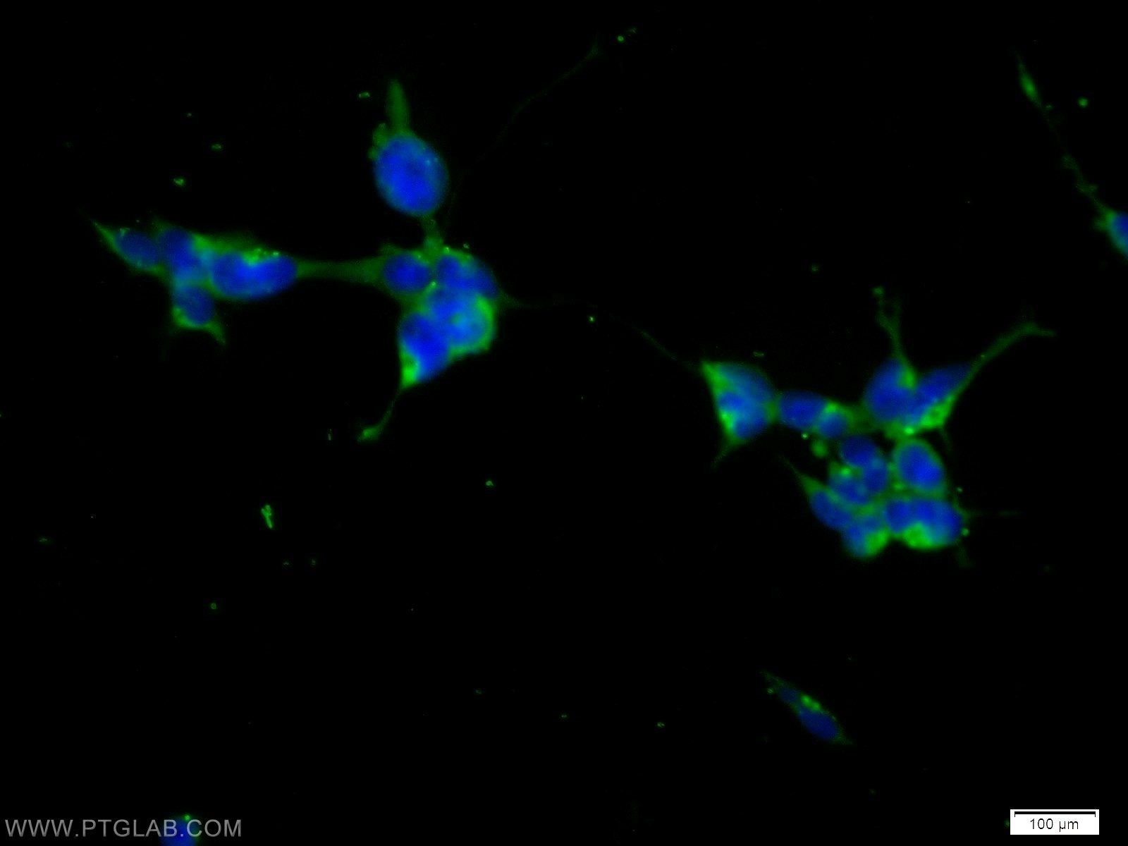 Immunofluorescence (IF) / fluorescent staining of HEK-293 cells using KIF15 Polyclonal antibody (55407-1-AP)