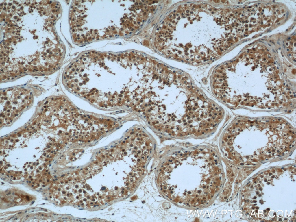 Immunohistochemistry (IHC) staining of human testis tissue using KIF15 Polyclonal antibody (55407-1-AP)