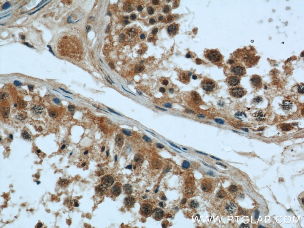 Immunohistochemistry (IHC) staining of human testis tissue using KIF15 Polyclonal antibody (55407-1-AP)