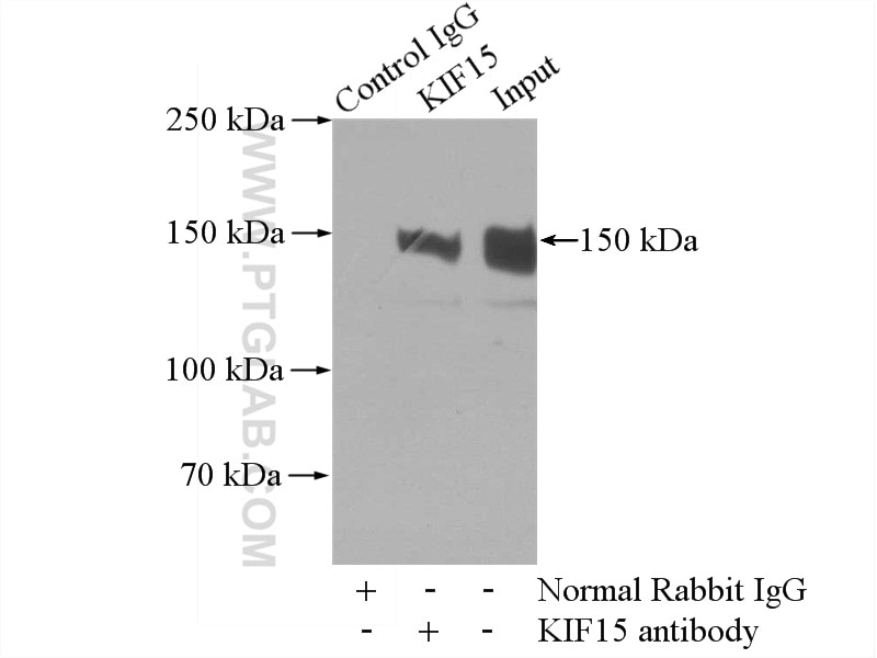 Immunoprecipitation (IP) experiment of mouse thymus tissue using KIF15 Polyclonal antibody (55407-1-AP)