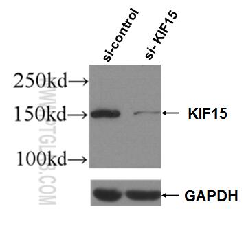Western Blot (WB) analysis of Jurkat cells using KIF15 Polyclonal antibody (55407-1-AP)