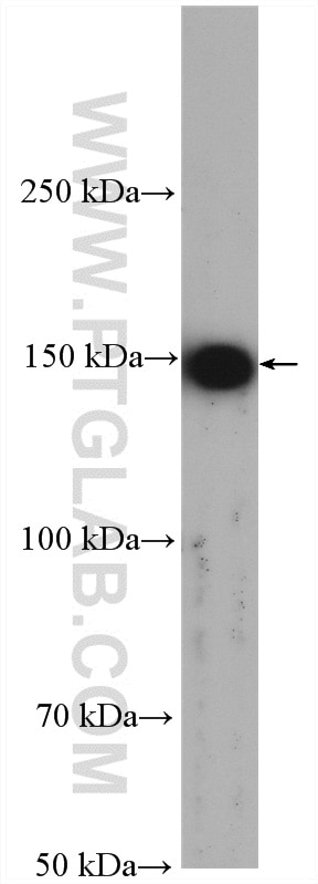 Western Blot (WB) analysis of MDA-MB-453s cells using KIF15 Polyclonal antibody (55407-1-AP)