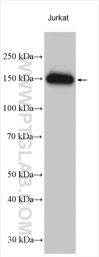 Western Blot (WB) analysis of various lysates using KIF15 Polyclonal antibody (55407-1-AP)