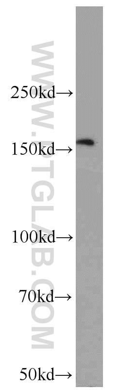 WB analysis of mouse thymus using 55407-1-AP