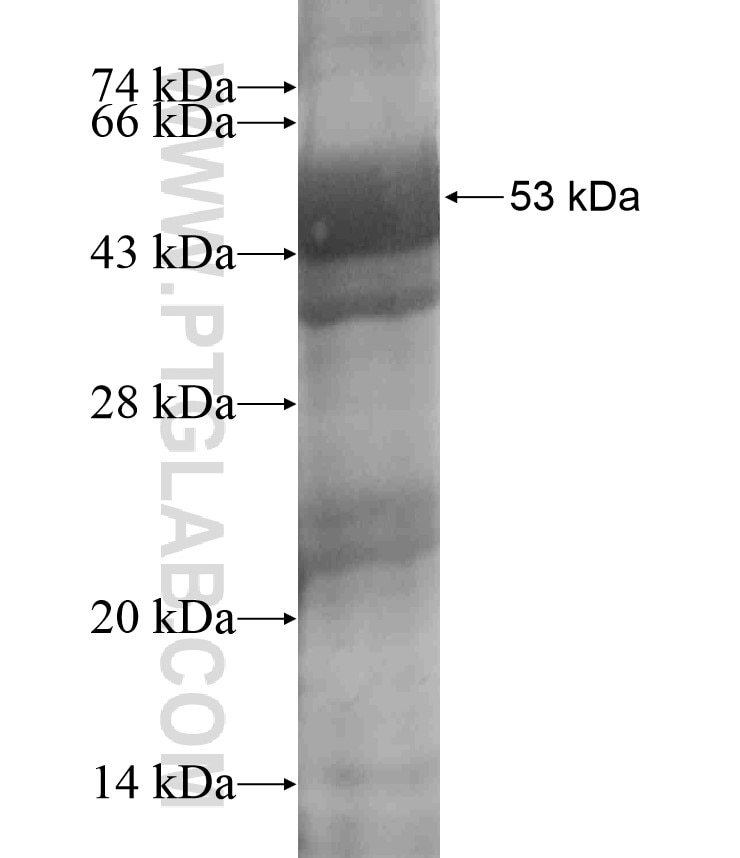 KIF16B fusion protein Ag18234 SDS-PAGE