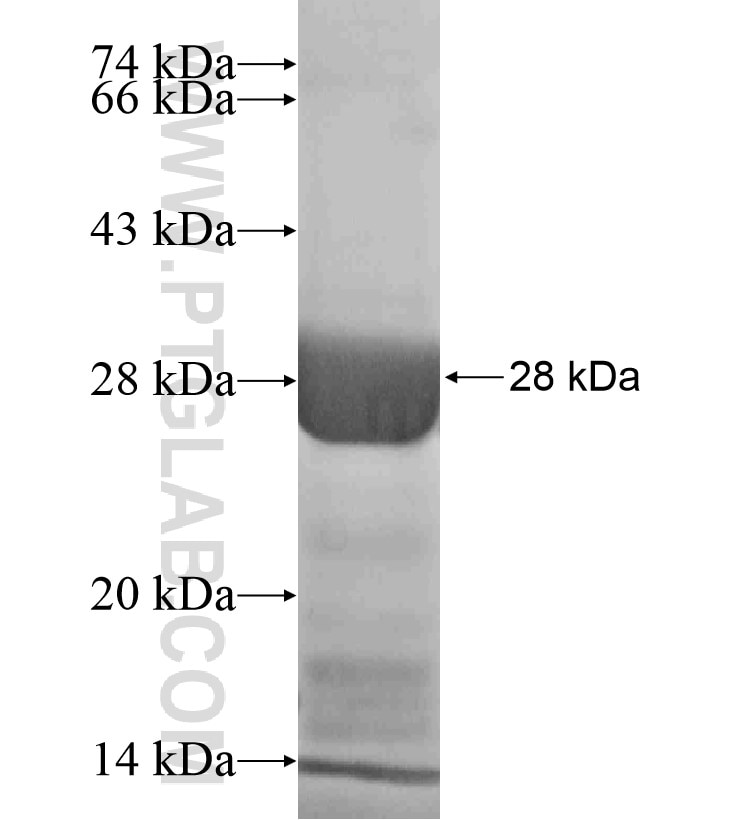 KIF16B fusion protein Ag18352 SDS-PAGE