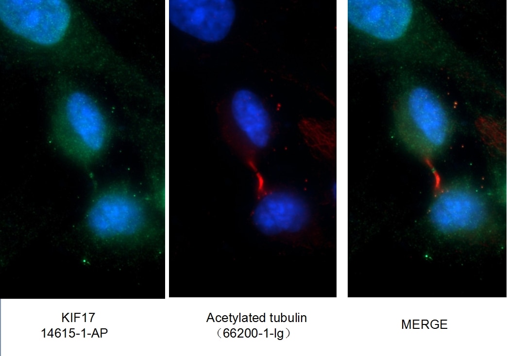 IF Staining of COS-7 using 14615-1-AP