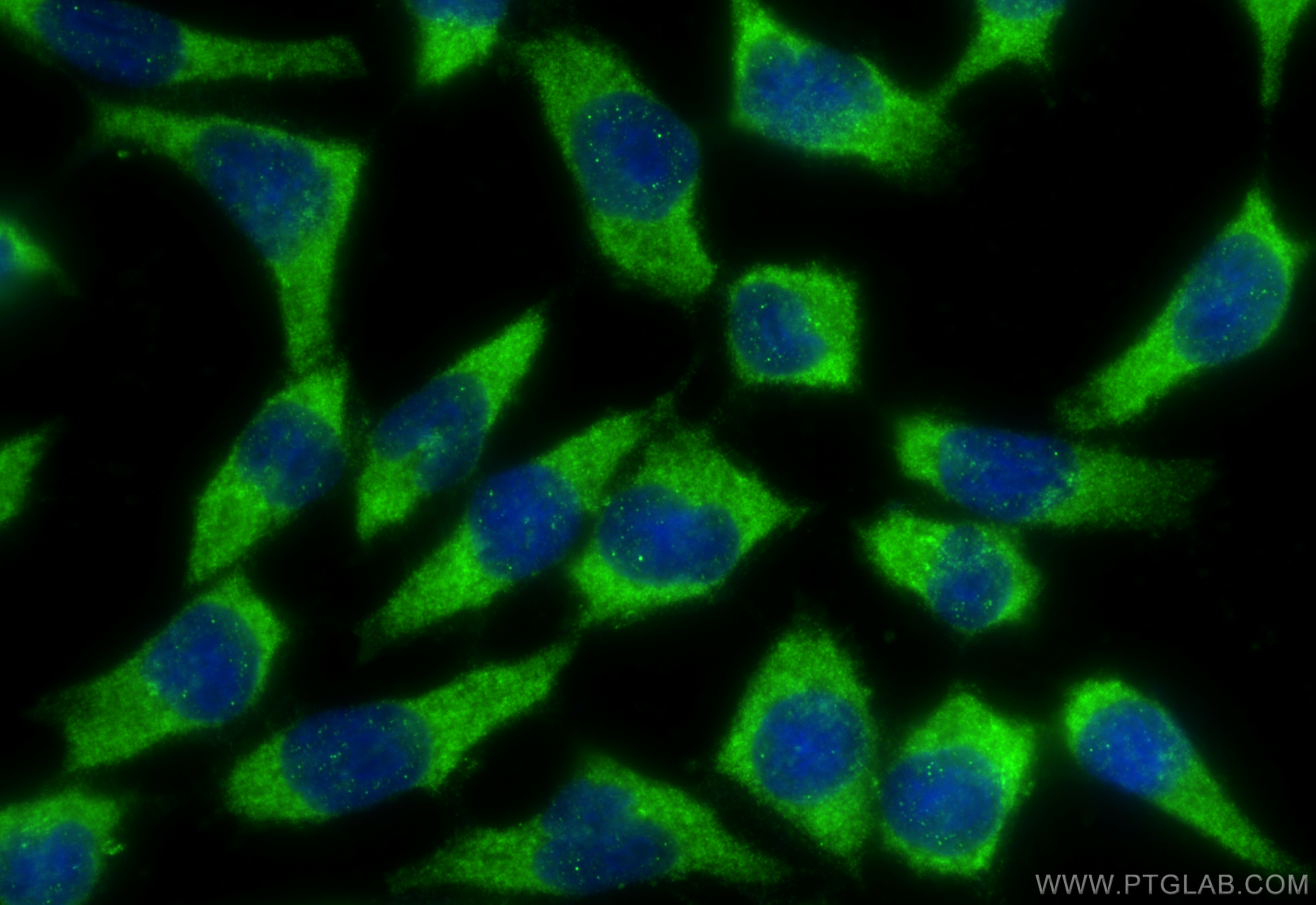 Immunofluorescence (IF) / fluorescent staining of COS-7 cells using KIF17 Polyclonal antibody (14615-1-AP)